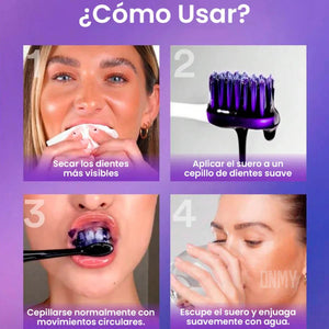 SmileKit® Blanqueador Dental: ¡Blanquea tus Dientes en 30 SEGUNDOS! 💜✨